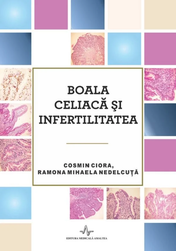 Boala celiaca si infertilitatea - Cosmin Ciora, Ramona Mihaela Nedelcuta