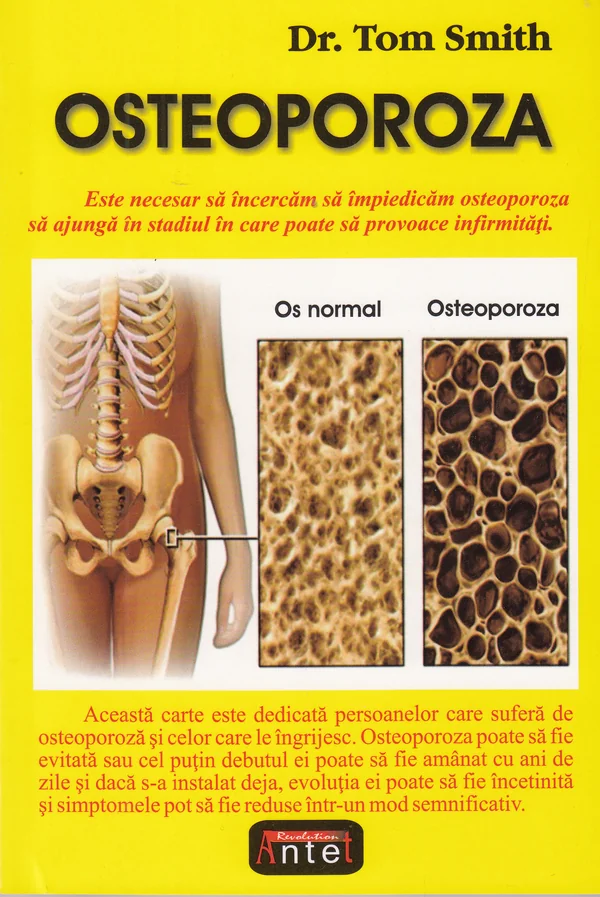 Osteoporoza